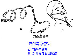 ◆肺病患者如何家庭氧療？